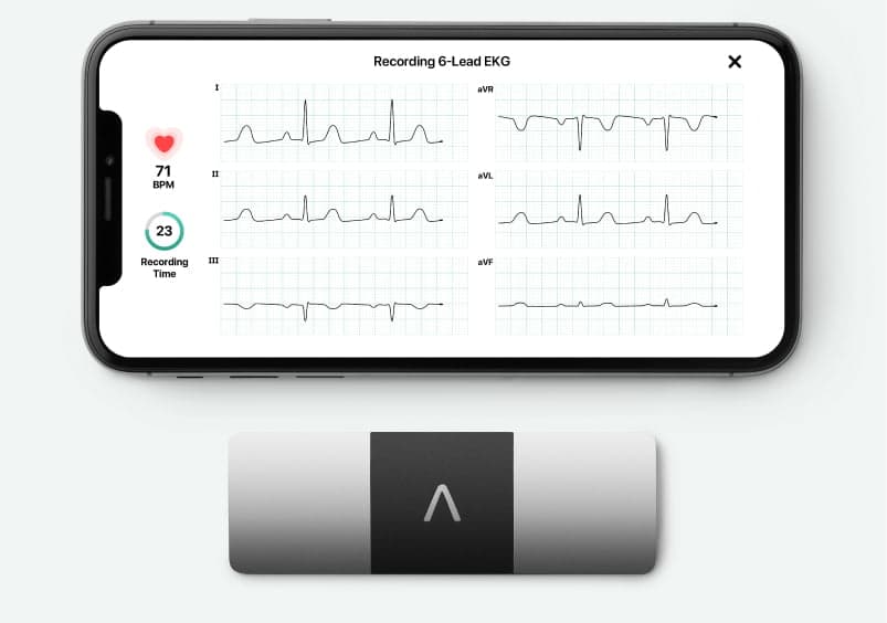 KardiaMobile 6L